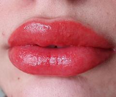 Косметолог -иньекционист в Актау - 2