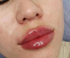 Косметолог -иньекционист в Актау - 3