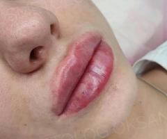 Косметолог -иньекционист в Актау - 4